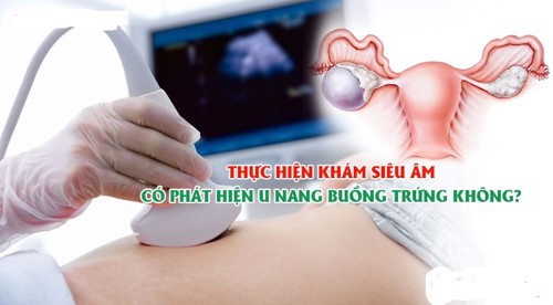 Thực hiện khám siêu âm có phát hiện u nang buồng trứng không?